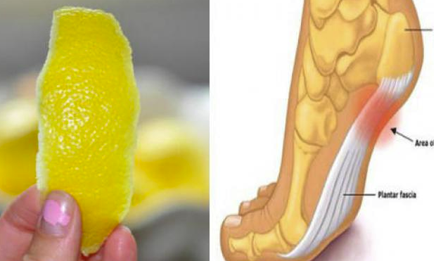 Всички знаем колко здравословни са лимоните но знаехте ли че