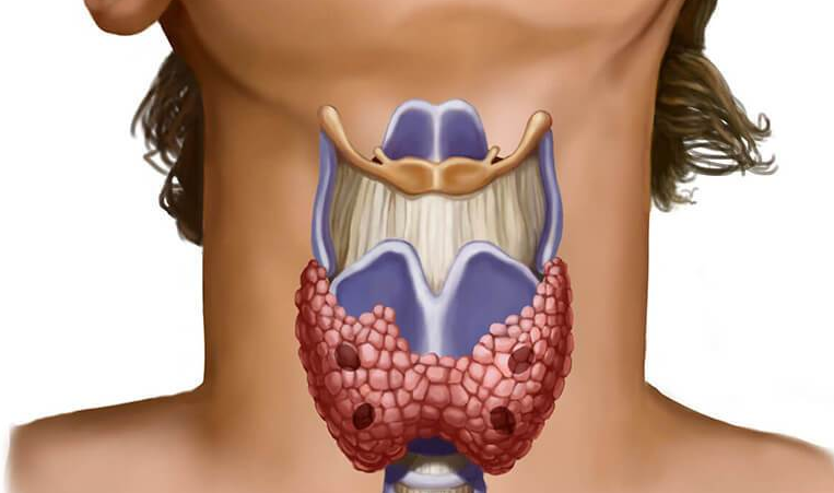Щитовидната жлеза е малък орган, който се намира в долната