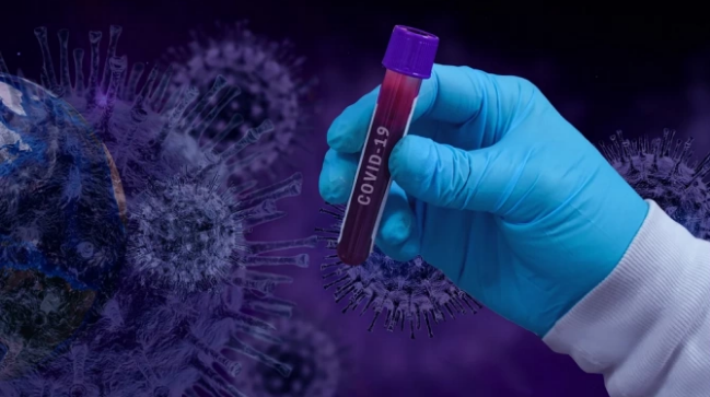 Световната здравна организация СЗО призова най засегнатите от коронавирусната пандемия страни