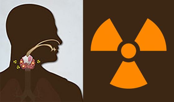 Информацията за повишен радиационен фон в областта на Чернобил (и