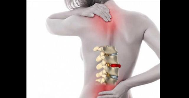 Упражнение за премахване на болката в гърба за няколко минути