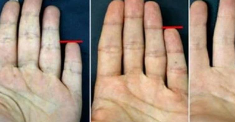Най малкият пръст на ръката има важна информация за вас