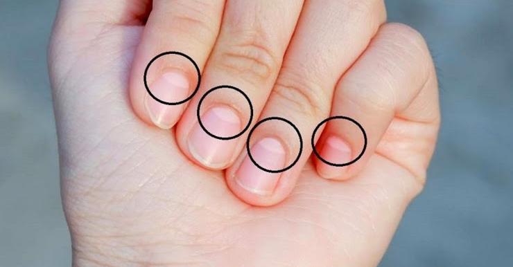 Ако се вгледате в ноктите си може да забележите бледи
