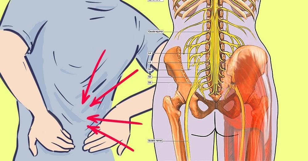 Причините за болка в гърба могат да бъдат различни  На
