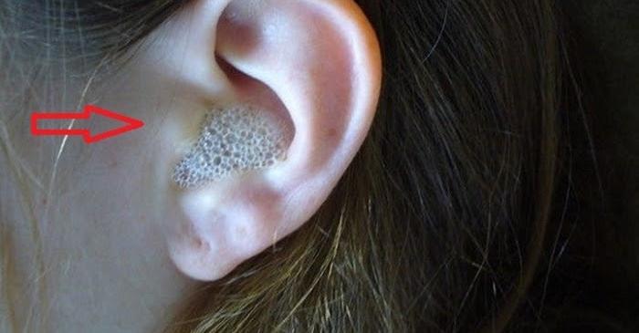 Ушната кал е вещество което се намира във вътрешното ухо