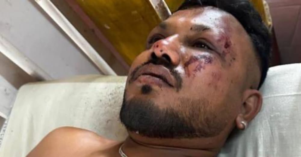 Вишваш Кумар Рамеш – британско индийски гражданин – е единственият потвърден