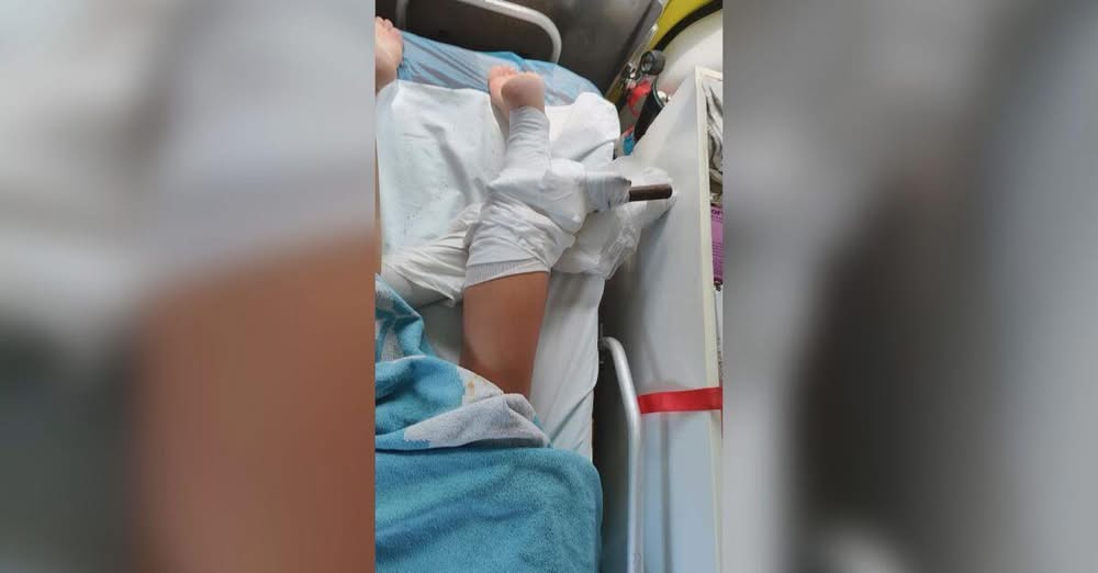 Дръжка от плажен чадър се е забила в крака на