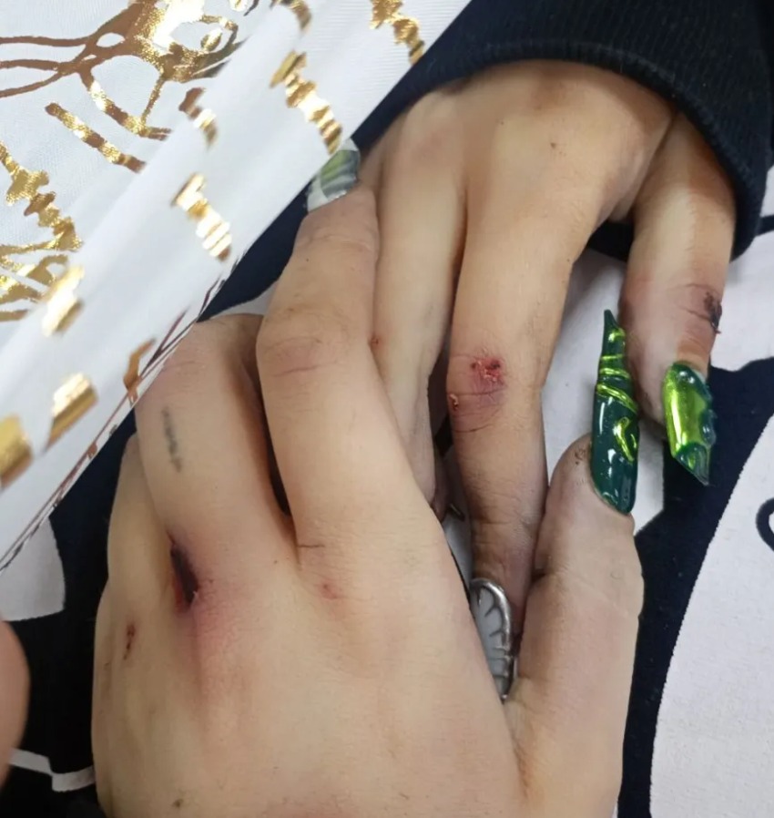 Бащата на 16 годишната Ивана Стойнева която загина след падане от